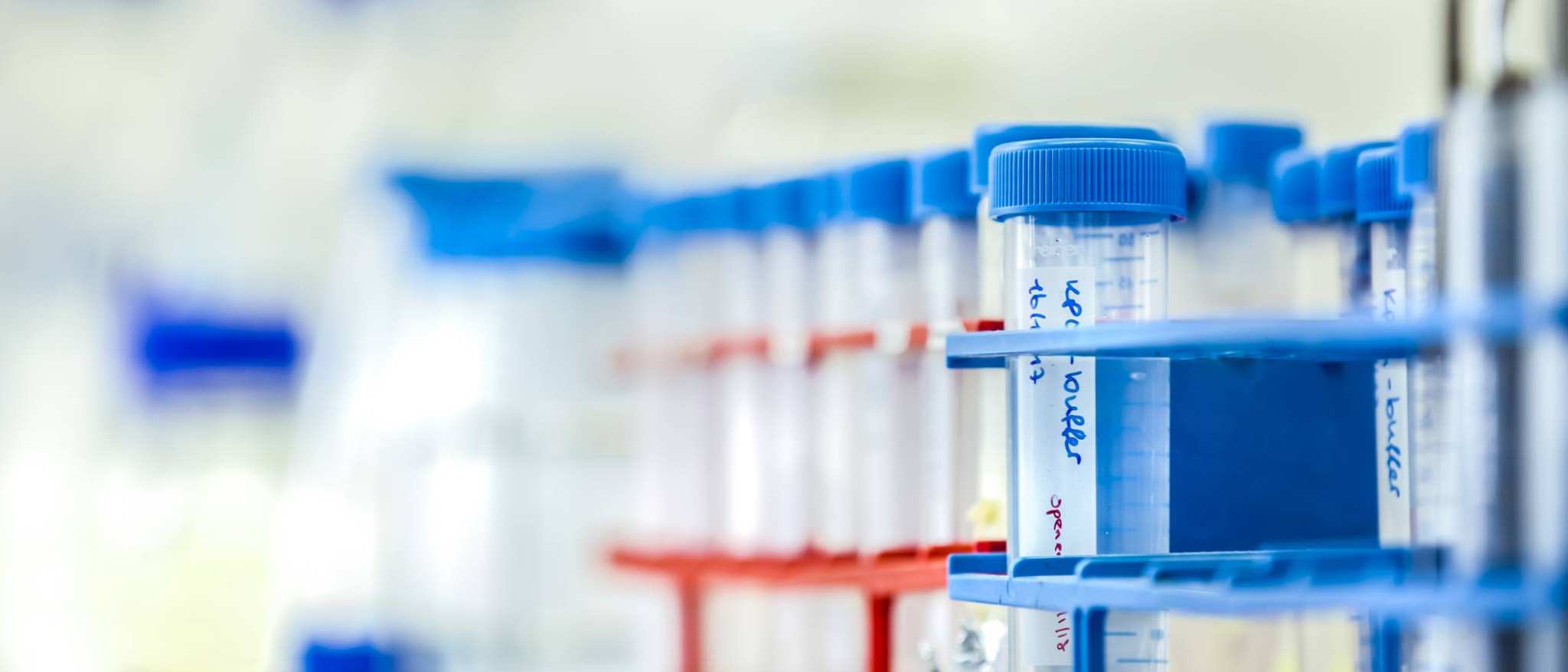 reageerbuisjes in een rek