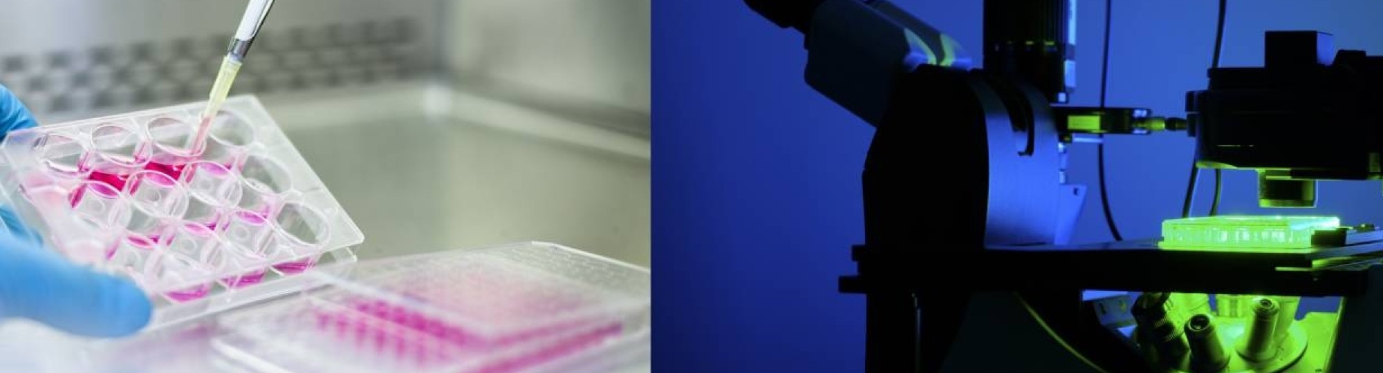 Organoid, microscoop en labonderzoek staan voor drug discovery.